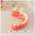 China Medical Anatomical Model Removable Soft Gingiva Standard Dental Jaw Model 13017